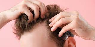 The Ultimate Guide To FUT+FUE+BHT Combination Method