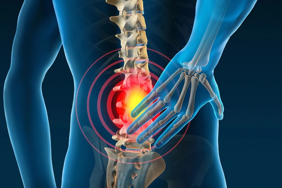 Beyond the Pills: Non-Drug Treatments for Chronic Lower Back Pain