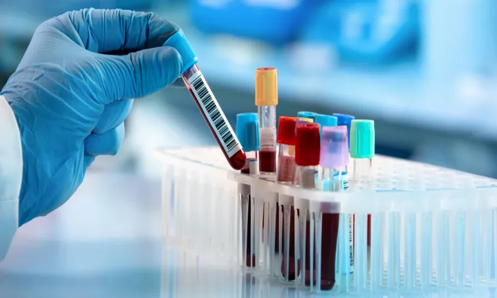 Diagnostic Tests: Common Health Tests You Should Know About