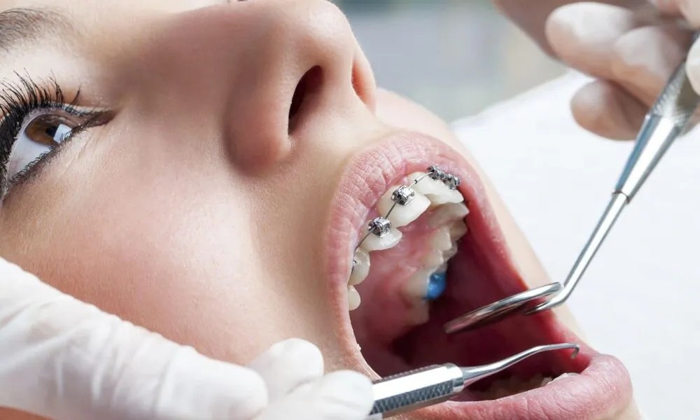 Dental Restoration Explained: Types and Materials