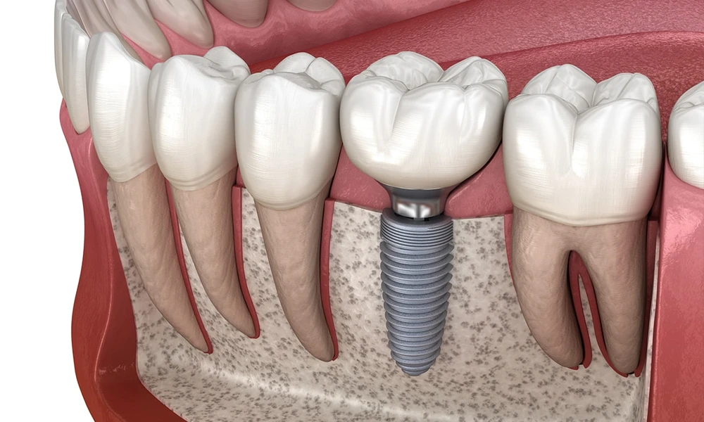 Emergency Dental Situations Explained: When You Should Seek Immediate Professional Care