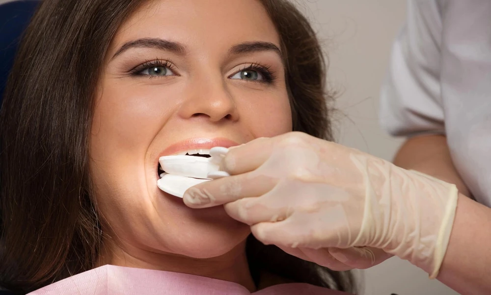 How Long Does Opalescence Teeth Whitening Take to Show Results?
